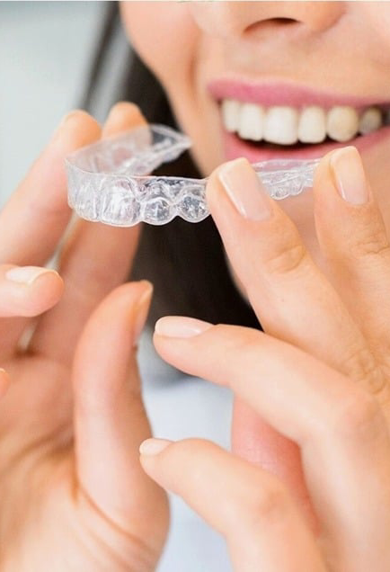 invisalign-side-img