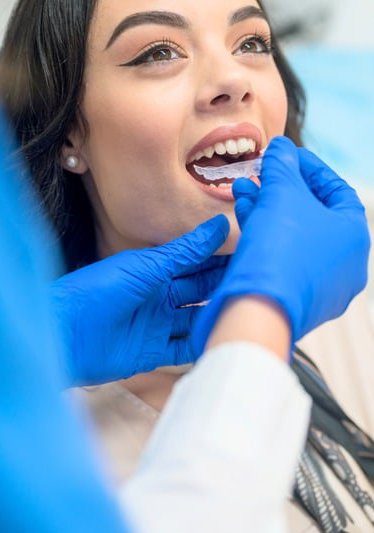 retainer-installation-side-img